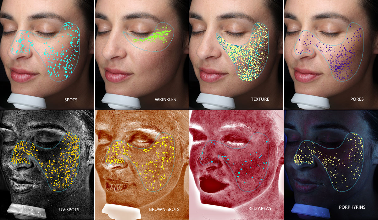 VISIA SKIN ANALYSIS